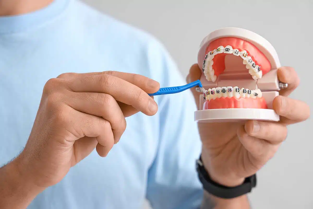 Caring for Braces: A Simple Daily Routine